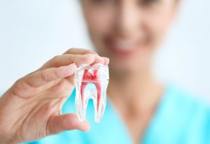 Root Canal in Port Coquitlam