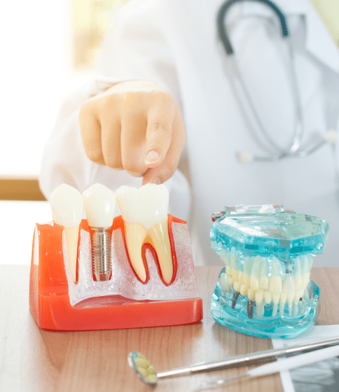 Dental Implants Port Moody
