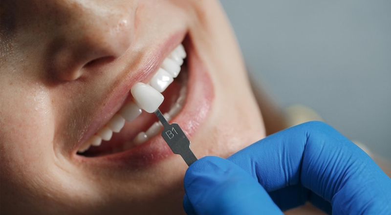 What to keep in mind when choosing an emergency dentist? - PoCo Dental Group