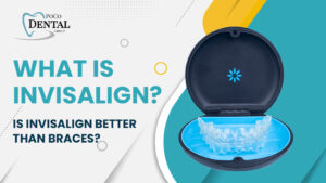 WHAT IS INVISALIGN? IS INVISALIGN BETTER THAN BRACES?