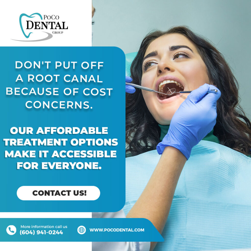 Root Canal Treatment Port Coquitlam