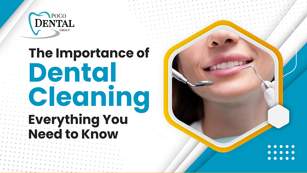 The Importance of Dental Cleaning