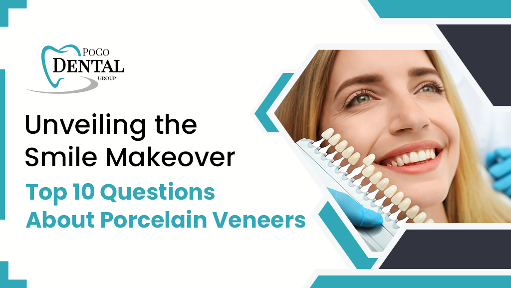 Top 10 Questions About Porcelain Veneers