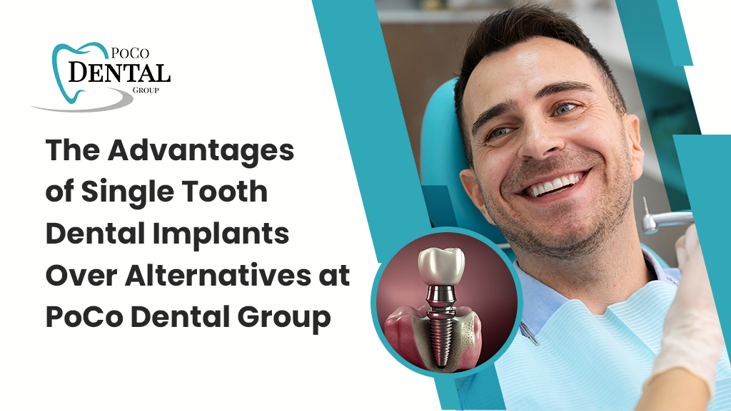 The Advantages of Single Tooth Dental Implants Over Alternatives
