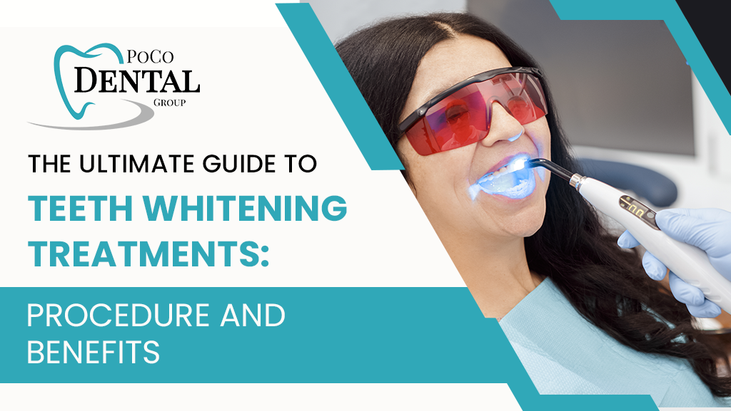 The Ultimate Guide to Teeth Whitening Treatments: Procedure and Benefits