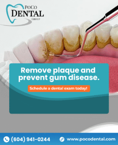 Benefits of Dental Cleanings