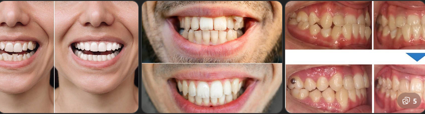 Complexity of Your Dental Case