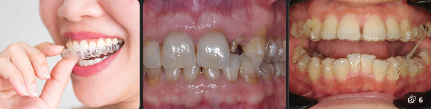 Use of Attachments and Additional Tools