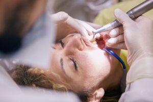 Can I Drive After a Root Canal