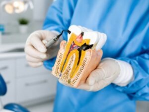 can I get a root canal on an infected tooth
