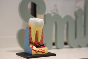 Gum Disease Treatment in Port Coquitlam