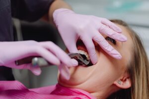 Who Is a Good Candidate for Dental Veneers?